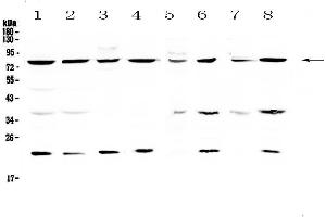 Western blot analysis of MRE11 using anti-MRE11 antibody . (Mre11 anticorps  (AA 2-239))