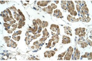 Rabbit Anti-RHOT1 Antibody  Paraffin Embedded Tissue: Human Muscle Cellular Data: Skeletal muscle cells Antibody Concentration: 4.