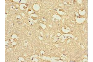 Immunohistochemistry of paraffin-embedded human brain tissue using ABIN7152437 at dilution of 1:100 (FBXO4 anticorps  (AA 138-387))