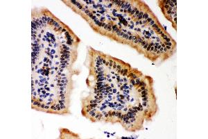 Anti- KAT3B/p300 Picoband antibody, IHC(P) IHC(P): Mouse Intestine Tissue