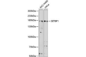 Western blot analysis of extracts of various cell lines, using SETBP1 antibody (ABIN6132919, ABIN6147635, ABIN6147636 and ABIN6223042) at 1:1000 dilution. (SETBP1 anticorps  (AA 1-242))