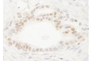 Immunohistochemistry (IHC) image for anti-DEK Oncogene (DEK) (AA 325-375) antibody (ABIN7453826)