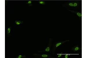 Immunofluorescence of monoclonal antibody to STK24 on HeLa cell. (STK24 anticorps  (AA 1-431))