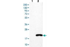 Western blot analysis of Lane 1: Negative control (vector only transfected HEK293T lysate). (LGALS7 anticorps)