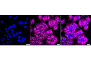 Immunocytochemical staining of HepG2 cells with Cholinergic receptor muscarinic 2 antibody (ABIN7798054), 1:1,000). (Recombinant Muscarinic Acetylcholine Receptor M2 anticorps)
