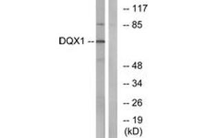 Western blot analysis of extracts from COS7 cells, using DQX1 Antibody. (DQX1 anticorps  (AA 551-600))