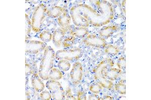 Immunohistochemistry of paraffin-embedded rat kidney using WRB antibody (ABIN5974453) at dilution of 1/200 (40x lens). (WRB anticorps)