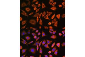 Immunofluorescence analysis of L929 cells using CNOT1 Rabbit pAb (ABIN6127561, ABIN6138777, ABIN6138778 and ABIN6221649) at dilution of 1:100.