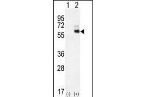 Western blot analysis of KNG1 (arrow) using rabbit polyclonal KNG1 Antibody (N-term) (ABIN655629 and ABIN2845108). (KNG1 anticorps  (N-Term))