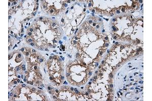 Immunohistochemical staining of paraffin-embedded Kidney tissue using anti-AKT2mouse monoclonal antibody. (AKT2 anticorps)