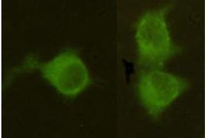 Immunocytochemistry stain of Hela using Mannose Phosphate Isomerase mouse mAb (1:300). (MPI anticorps)