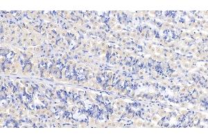 Detection of ASPH in Human Stomach Tissue using Polyclonal Antibody to Aspartate Beta Hydroxylase (ASPH)