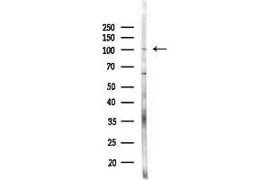 anti-Catenin (Cadherin-Associated Protein), alpha 2 (CTNNA2) (N-Term) antibody