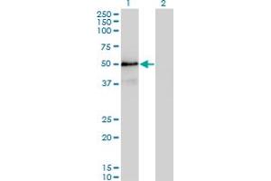 Western Blot analysis of SMAD3 expression in transfected 293T cell line by SMAD3 monoclonal antibody (M20), clone 4F9. (SMAD3 anticorps  (AA 147-270))