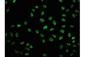 Immunofluorescence staining of Hela cells with ABIN7127757 at 1:100,counter-stained with DAPI.