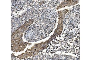 IHC analysis of Claudin 3/CLDN3 using anti-Claudin 3/CLDN3 antibody (ABIN7599626). (Claudin 3 anticorps  (AA 101-220))