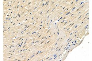 ABIN6262765 and ABIN6278912 at 1/100 staining Rat heart tissue by IHC-P. (KDM5A anticorps  (C-Term))