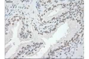 Image no. 14 for anti-Glial Fibrillary Acidic Protein (GFAP) antibody (ABIN1498440) (GFAP anticorps)