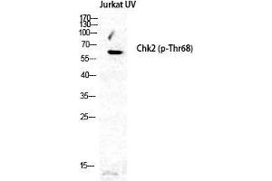 Western Blot (WB) analysis of specific cells using Phospho-Chk2 (T68) Polyclonal Antibody. (CHEK2 anticorps  (pThr68))