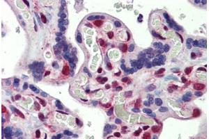 Placenta, Human: Formalin-Fixed, Paraffin-Embedded (FFPE)