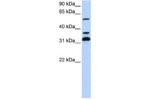 Western Blotting (WB) image for anti-Tripartite Motif Containing 9 (TRIM9) antibody (ABIN2458110) (TRIM9 anticorps)
