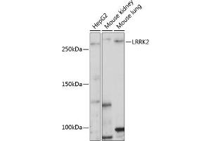 Western blot analysis of extracts of various cell lines, using LRRK2 Polyclonal Antibody  at 1:1000 dilution. (LRRK2 anticorps  (AA 2355-2527))
