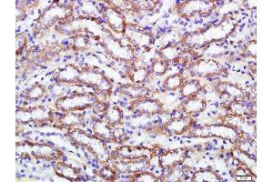 Paraformaldehyde-fixed, paraffin embedded rat kidney, Antigen retrieval by boiling in sodium citrate buffer (pH6) for 15min, Block endogenous peroxidase by 3% hydrogen peroxide for 30 minutes, Blocking buffer (normal goat serum) at 37°C for 20min, Antibody incubation with 	ADAM17 Polyclonal Antibody, Unconjugated  at 1:200 overnight at 4°C, followed by a conjugated secondary and DAB staining.