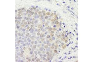 Immunohistochemistry (IHC) image for anti-GATA Zinc Finger Domain Containing 2B (GATAD2B) (AA 50-100) antibody (ABIN7448709) (GATAD2B anticorps  (AA 50-100))