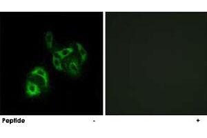 Immunofluorescence analysis of A-549 cells, using SLC27A4 polyclonal antibody .