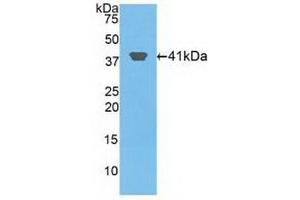 Detection of Recombinant HIST2H2AA3, Human using Polyclonal Antibody to Histone Cluster 2, H2aa3 (HIST2H2AA3) (HIST2H2AA3 anticorps  (AA 1-130))