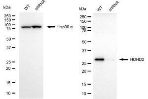 Western blotting analysis using HDHD2 antibody (ABIN7798835).