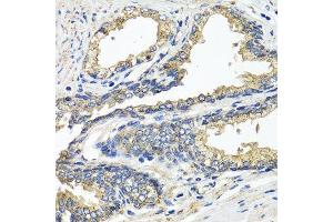 Immunohistochemistry of paraffin-embedded human prostate using ETFA antibody. (ETFA anticorps  (AA 1-333))