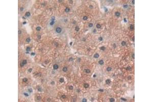 IHC-P analysis of Human Tissue, with DAB staining. (ODC1 anticorps  (AA 234-453))