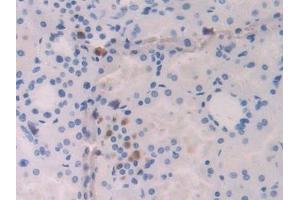 Used in DAB staining on fromalin fixed paraffin- embedded kidney tissue (IL-18 anticorps  (AA 37-193))