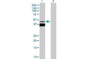 Western Blot analysis of ASPN expression in transfected 293T cell line by ASPN MaxPab polyclonal antibody. (Asporin anticorps  (AA 1-384))