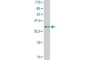 Western Blot detection against Immunogen (35. (NFKBIB anticorps  (AA 56-145))