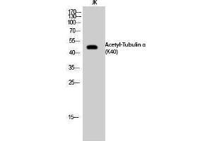 Western Blotting (WB) image for anti-alpha Tubulin (TUBA1) (acLys40) antibody (ABIN3172844) (alpha Tubulin anticorps  (acLys40))