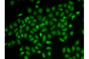 Immunofluorescence analysis of HeLa cells using COIL antibody.