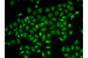 Immunofluorescence analysis of HeLa cells using COIL antibody. (Coilin anticorps  (AA 297-576))