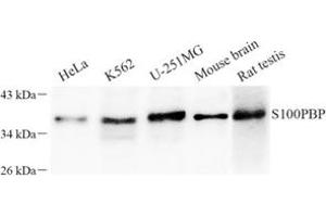Western blot analysis of S100PBP (ABIN7075500) at dilution of 1: 100 (S100PBP anticorps)