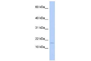 WB Suggested Anti-ISCA2 Antibody Titration: 0. (ISCA2 anticorps  (Middle Region))