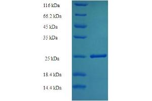 SDS-PAGE (SDS) image for Vasohibin 1 (VASH1) (AA 1-204) protein (His tag) (ABIN5711437)