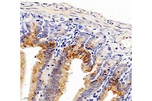 Immunohistochemistry of paraffin embedded mouse small intestine using Aldh4a1 (ABIN7073000) at dilution of 1: 1200 (400x lens)