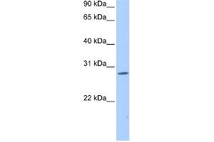 WB Suggested Anti-NRIP3 Antibody Titration:  0. (NRIP3 anticorps  (Middle Region))