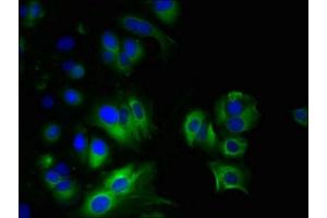 Immunofluorescent analysis of MCF-7 cells using ABIN7160482 at dilution of 1:100 and Alexa Fluor 488-congugated AffiniPure Goat Anti-Rabbit IgG(H+L) (MYADM anticorps  (AA 1-40))