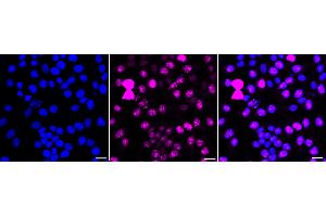 Immunocytochemical staining of HeLa cells with Phospho-Nucleolin (T84) antibody (ABIN7799670), 1:1,000).