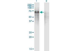 Western Blot analysis of PPP2R5C expression in transfected 293T cell line by PPP2R5C monoclonal antibody (M01), clone 3G9. (PPP2R5C anticorps  (AA 1-100))