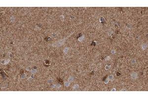 anti-Endophilin-A1 (SH3G2) (Internal Region) antibody