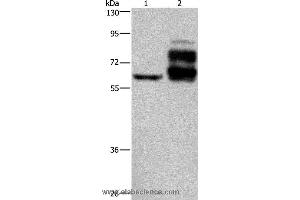 Western blot analysis of Jurkat cell and human rectal cancer tissue, using PCSK9 Polyclonal Antibody at dilution of 1:200 (PCSK9 anticorps)