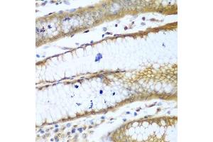 Immunohistochemistry of paraffin-embedded human stomach using ROCK1 antibody. (ROCK1 anticorps  (AA 400-660))